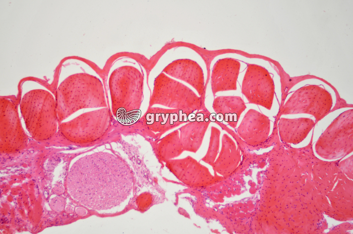 Tendon CT x25 - gryphea.com